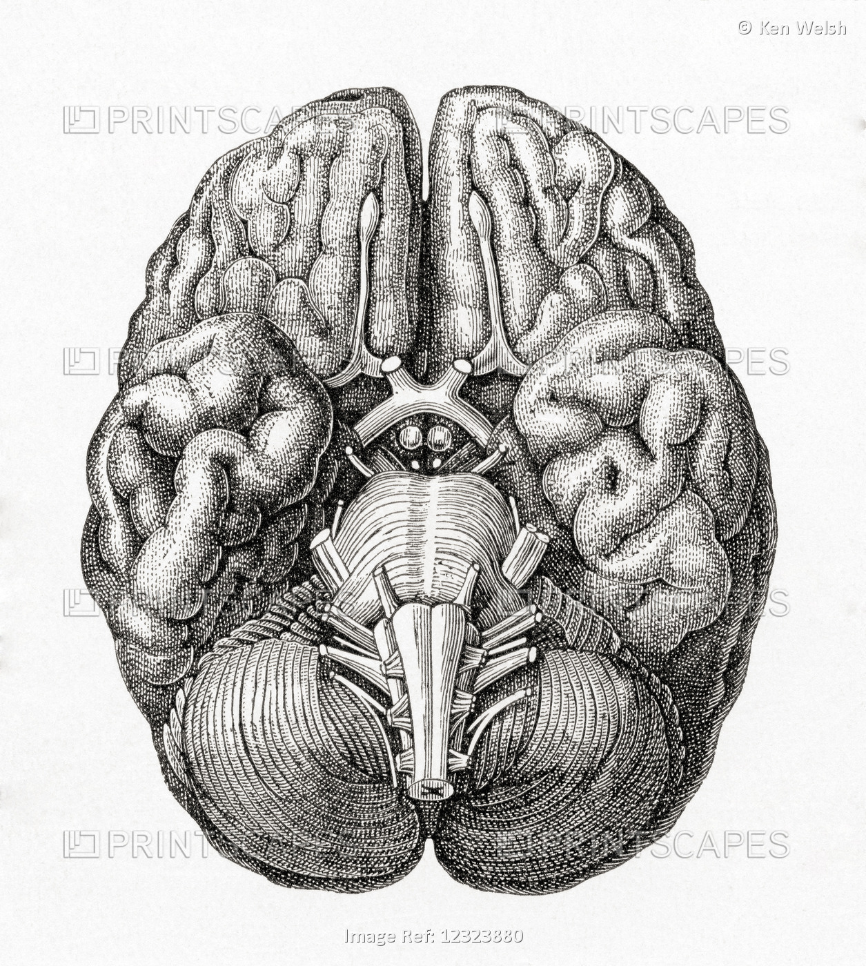 Diagram Of The Human Cerebellum Seen From Below. From Meyers Lexicon, Published ...
